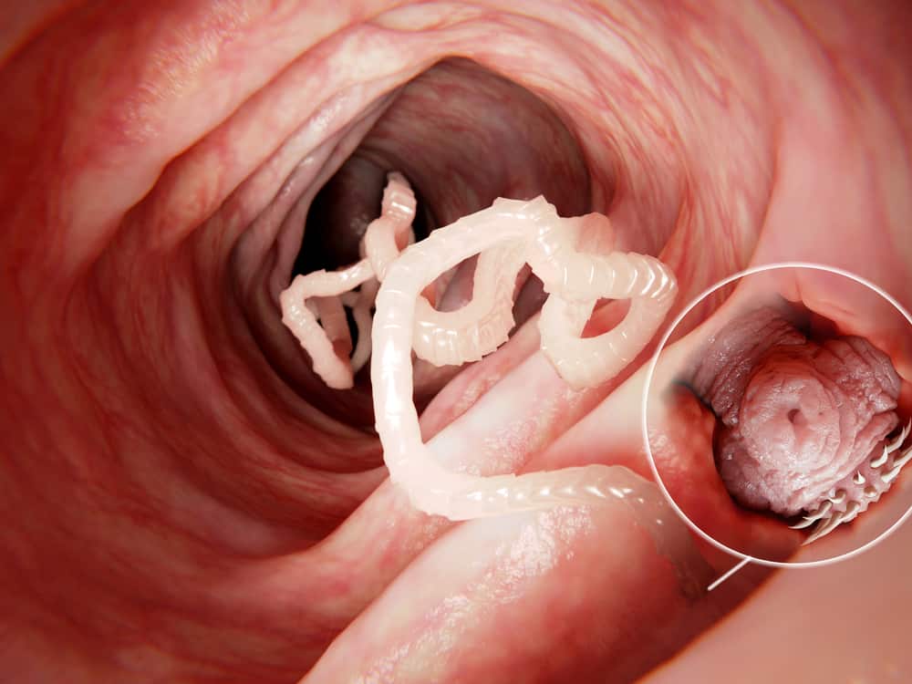 Tapeworm in human intestine